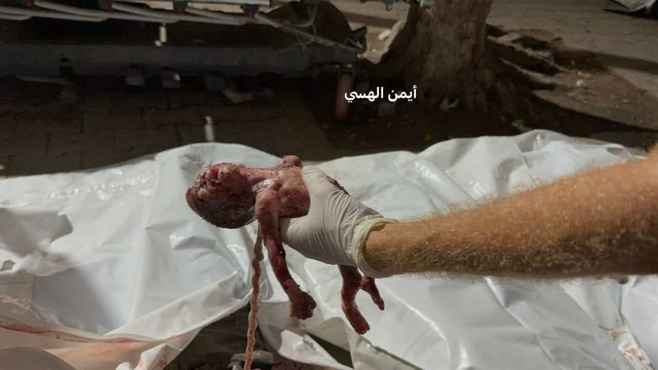 Zionists evil Jews war against the innocent unborn in Gaza